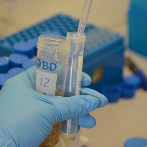 Australia-funded research fights aflatoxin contamination in East African&nbsp;foods